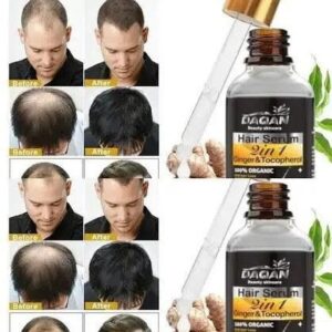 Daqan 30ml Anti-Hair Loss Hair Serum 2in1 Ginger & Tocopherol